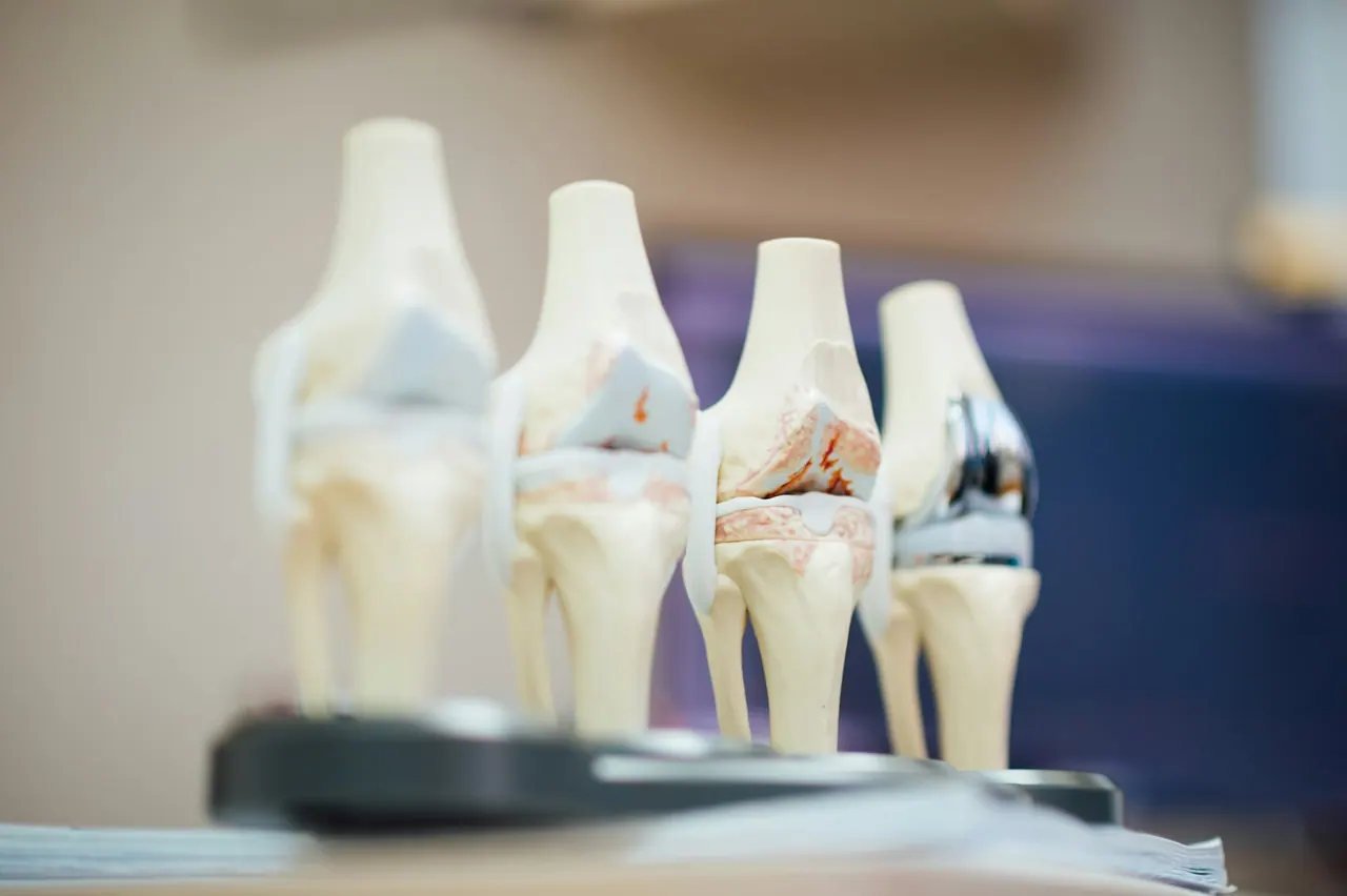 Knee joint models lined up on a table in soft light